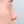 Nasal tip augmentation with donor (acellular) dermal matrix — before (20days) · Batang Plastic Surgery Clinic