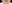 唇のヒアルロン酸注入（リップヒアルロン酸） — ロリポップ美容外科クリニック