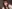 鼻尖形成術（自家軟骨移植） — D-day美容外科クリニック