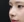Protruding mouth correction (anterior segmental osteotomy / orthodontic setback) — after (30days) · ES Cheongdam Plastic Surgery Clinic