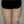 Full-body liposuction — before (21days) · Aurora Clinic
