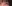 裏ハムラ法（経結膜的眼窩脂肪移動術） — オブジェ美容外科クリニック