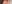 裏ハムラ法（経結膜的眼窩脂肪移動術） — ファクト美容外科クリニック