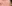 お腹の脂肪溶解注射 — ドクター美美容外科クリニック