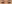 唇のヒアルロン酸注入（リップヒアルロン酸） — フルルン美容外科クリニック