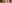 裏ハムラ法（経結膜的眼窩脂肪移動術） — プレジャー美容外科クリニック