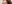 糸リフト（スレッドリフト） — A-Top美容外科クリニック
