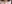 裏ハムラ法（経結膜的眼窩脂肪移動術） — オブジェ美容外科クリニック