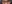 裏ハムラ法（経結膜的眼窩脂肪移動術） — プレジャー美容外科クリニック