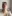 Double chin liposuction (submental liposuction) — Seoul During Clinic