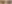 二重まぶた（自然癒着法） — タンキュー美容外科クリニック