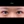 ผ่าตัดแก้ขนตาทิ่มตา (ขนตาแยงตา / เปลือกตาม้วนเข้า) — ก่อนทำ (14วัน) · รพ.ศัลยกรรมตกแต่งโอลโล