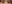 二重まぶた（自然癒着法） — プロミス美容外科クリニック