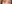 裏ハムラ法（経結膜的眼窩脂肪移動術） — エイペックス美容外科クリニック