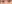 裏ハムラ法（経結膜的眼窩脂肪移動術） — ファクト美容外科クリニック