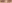 二重まぶた（自然癒着法） — ゼロワン美容外科クリニック