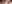 二重まぶた（自然癒着法） — プロミス美容外科クリニック