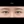 ผ่าตัดแก้ขนตาทิ่มตา (ขนตาแยงตา / เปลือกตาม้วนเข้า) — หลังทำ (7วัน) · รพ.ศัลยกรรมตกแต่งโอลโล