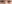 二重まぶた（自然癒着法） — プロミス美容外科クリニック