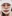 Revision facial contouring surgery (secondary facial bone surgery) — Uri Plastic Surgery Clinic
