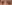 涙袋形成（脂肪注入） — ファクト美容外科クリニック