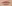 Lip filler (lip augmentation with HA) — Private Beauty Clinic Jiyu