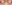 裏ハムラ法（経結膜的眼窩脂肪移動術） — ファクト美容外科クリニック