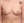 豊胸術（シリコンインプラント／人工乳腺） — 術前 (26日) · ザ・美容外科
