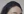 ปลูกผมบริเวณจอน — หลังทำ (360วัน) · คลินิกเสริมความงามเชียงดัมโอเค