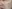 Pico Toning (picosecond laser toning) — Planner Plastic Surgery Clinic