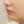 ฟิลเลอร์ใต้ตา (แก้ร่องใต้ตา / ขอบตาคล้ำ) — ก่อนทำ · คลินิกเสริมความงาม ด็อกเตอร์เซม