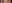 二重まぶた（自然癒着法） — ダビダ美容外科クリニック