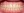 Clippy-C self-ligating ceramic braces (TOMY) — after (341days) · Yonsei Good Day Dental Clinic - Suseo Branch