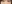 裏ハムラ法（経結膜的眼窩脂肪移動術） — アンド美容外科クリニック