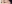 切開法（全切開法二重術） — IK美容外科クリニック