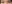 眼瞼下垂手術（目つき矯正） — ジェスタ美容外科クリニック