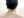 โบท็อกซ์หว่างคิ้ว — ก่อนทำ · คลินิก Mikae