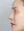 ผ่าตัดแก้ไขผนังกั้นช่องจมูกคด (Septoplasty) — หลังทำ (7วัน) · ทีวายพลาสติกเซอร์เจอรี่