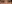 裏ハムラ法（経結膜的眼窩脂肪移動術） — ファクト美容外科クリニック