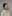 額縮小術（生え際下げ・ヘアライン下降術） — DM美容外科クリニック