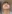 小鼻縮小術 — コ・アン・ミ美容外科クリニック