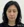 Belotero Revive (HA + glycerol skinbooster) — before (500days) · Ayun Clinic