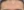 Botox for nasolabial folds — after (30days) · Ayun Clinic