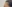 額（おでこ）のヒアルロン酸注入 — フルルン美容外科クリニック