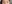 二重まぶた（自然癒着法） — プロミス美容外科クリニック