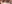 裏ハムラ法（経結膜的眼窩脂肪移動術） — アイニーク美容外科クリニック