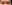 Ptosis Correction (levator surgery / eye-shape correction) — Thank You Plastic Surgery