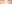 裏ハムラ法（経結膜的眼窩脂肪移動術） — SM美容外科クリニック