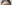 額縮小術（生え際下げ・ヘアライン下降術） — コウユ美容外科クリニック