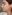 revision rhinoplasty — Coco Line Clinic